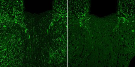 Left: Many bright green dots like a sky full of stars. Right: significantly fewer bright green dots.