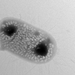 A transmission electron micrograph (TEM) image.
