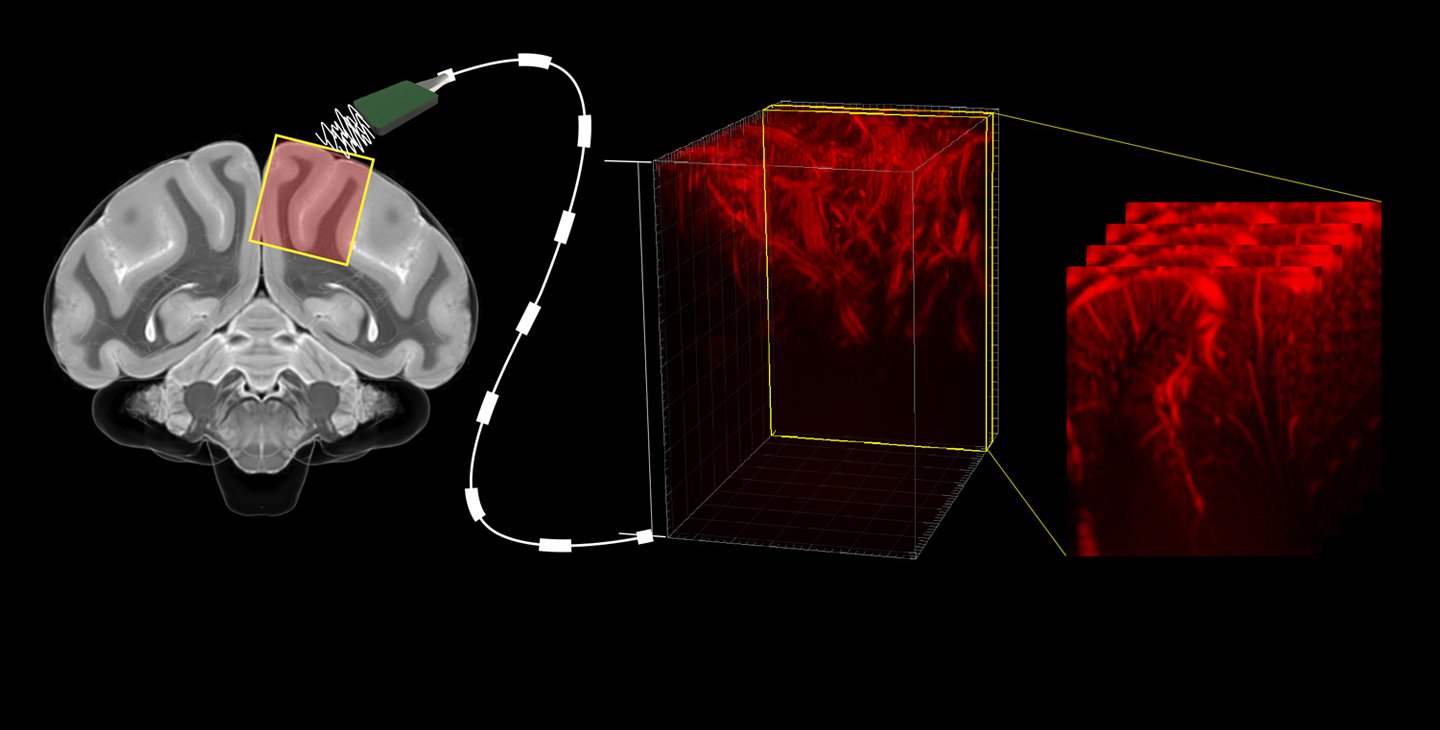A diagram illustrating a brain connected to a cable, that reads out brain activity and creates maps of the brain's vasculature.