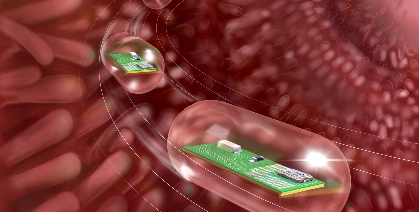 An artist's concept of a smart pill traveling through the digestive tract. A pill containing a circuit board is shown passing along the villi of the intestines.
