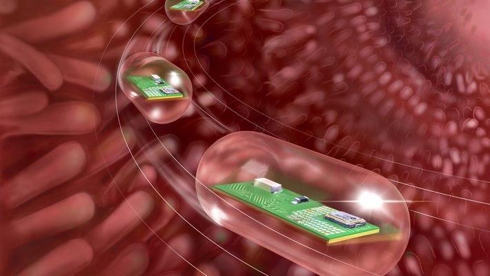 An artist's concept of a smart pill traveling through the digestive tract. A pill containing a circuit board is shown passing along the villi of the intestines.