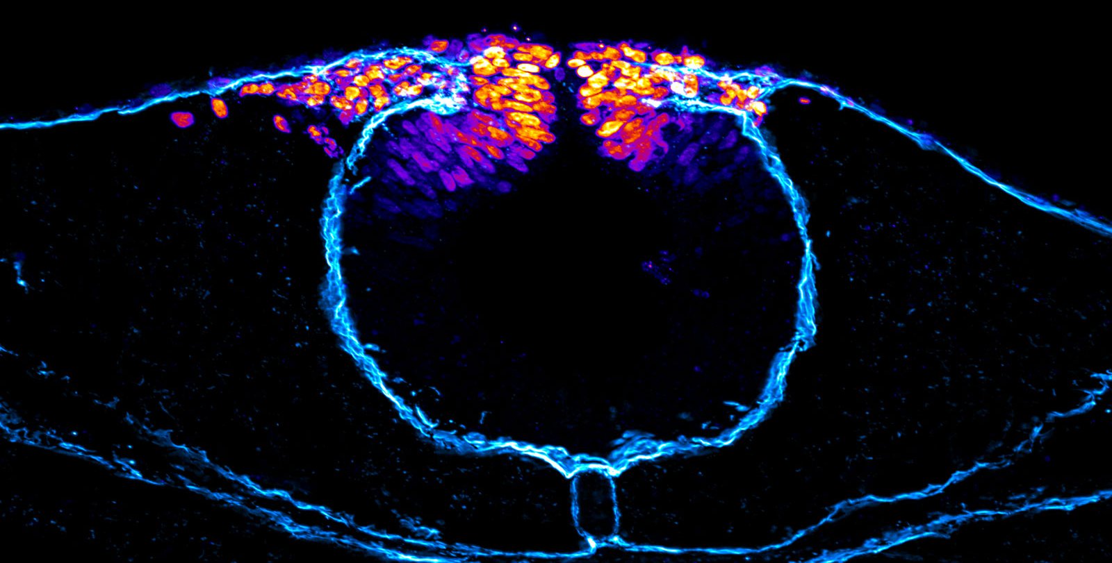 A false-colored image of neural crest cells unable to migrate