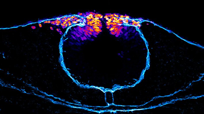 A false-colored image of neural crest cells unable to migrate