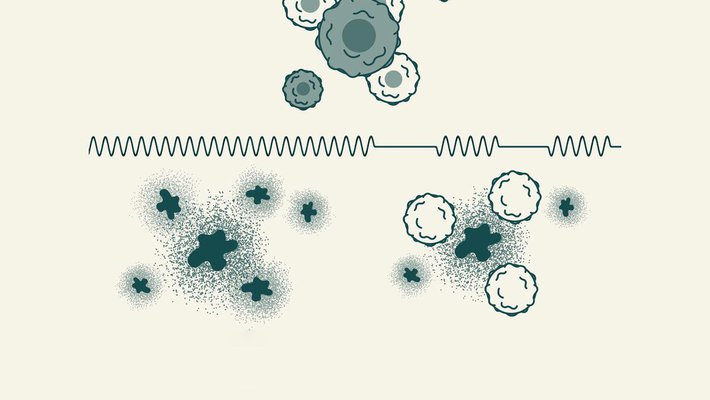 graphic of ultrasound destroying cancer cells