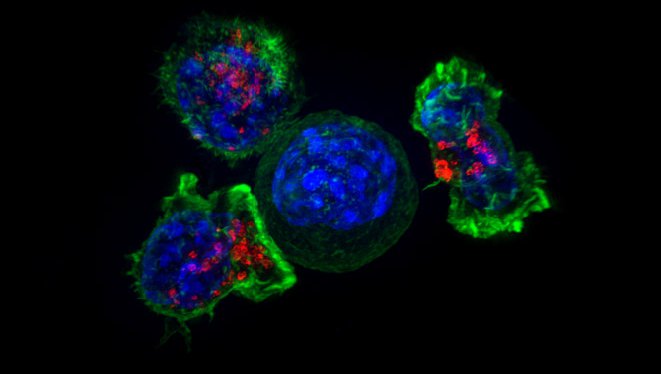 T cells surround a cancer cell