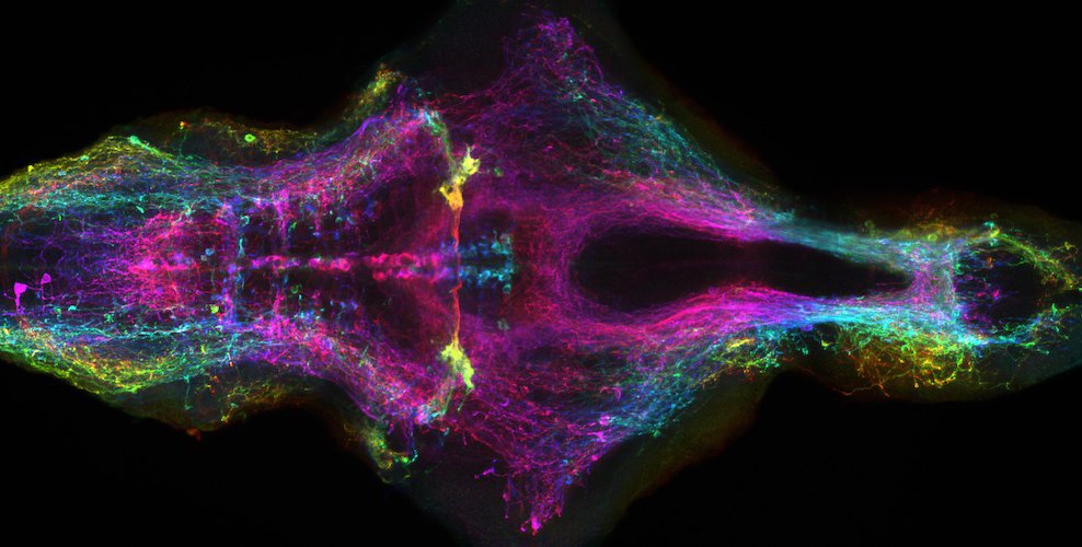 A brighty colored microscope image of the brain of a zebrafish