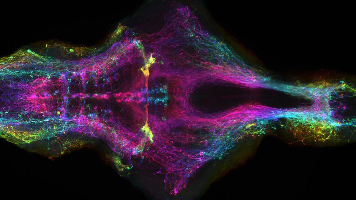 A brighty colored microscope image of the brain of a zebrafish