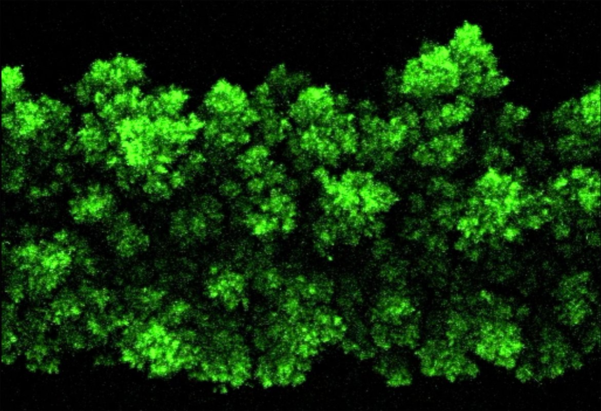 fluorescent green clumps on a black background