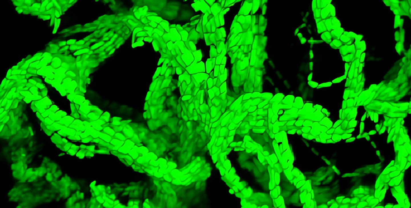 Glowing green serpentine "cables" made up of proliferating bacterial cells.