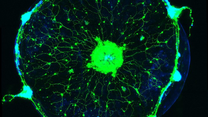 A glowing green circle speckled with green dots.