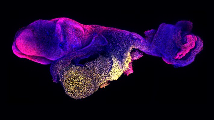 An oblong shape stained in purple and pink swirled together