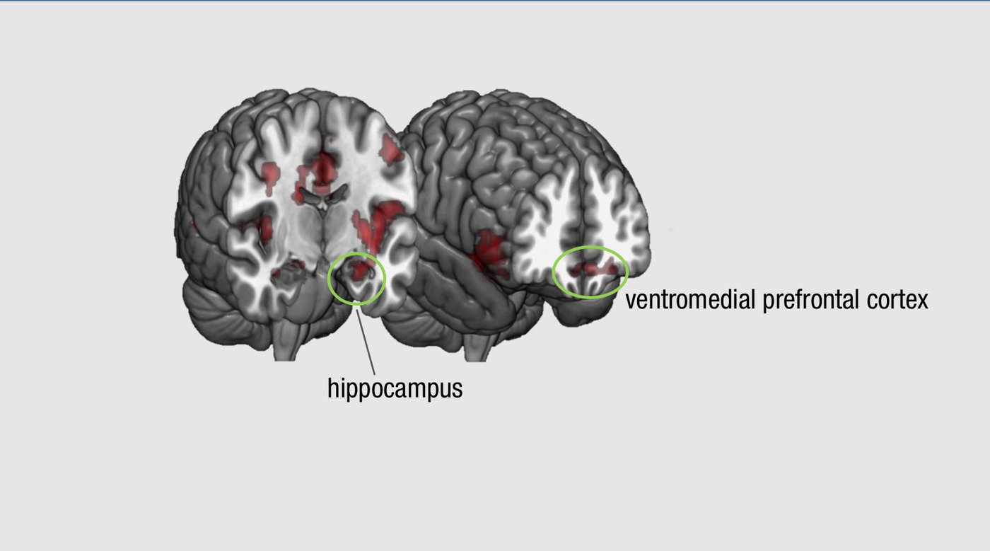 Picture of brain slice