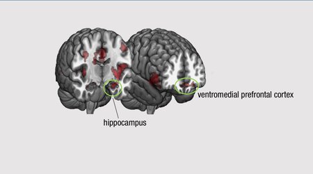 Picture of brain slice