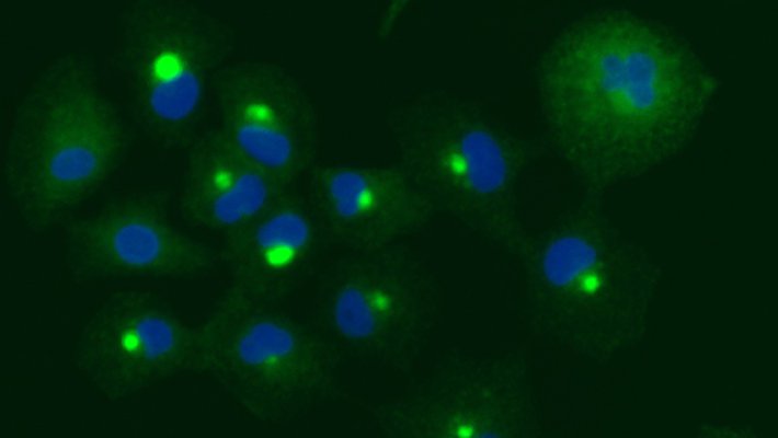 Green and blue fluorescent dots.