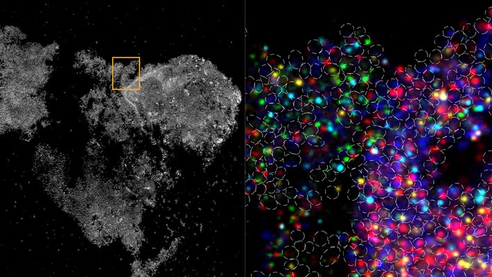 A black and white image of a group of cells, next to a close up with vivid fluorescent colors