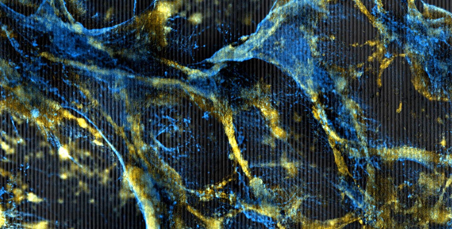 A web of orange cells tangled with a thin blue matrix