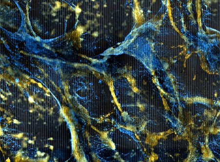 A web of orange cells tangled with a thin blue matrix