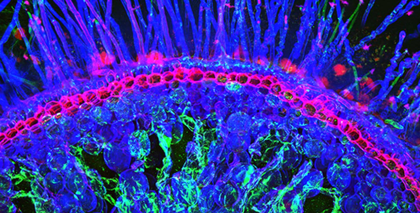 A fluorescent image of the tips of maize roots with bacteria stained in pink at their tips and bases.