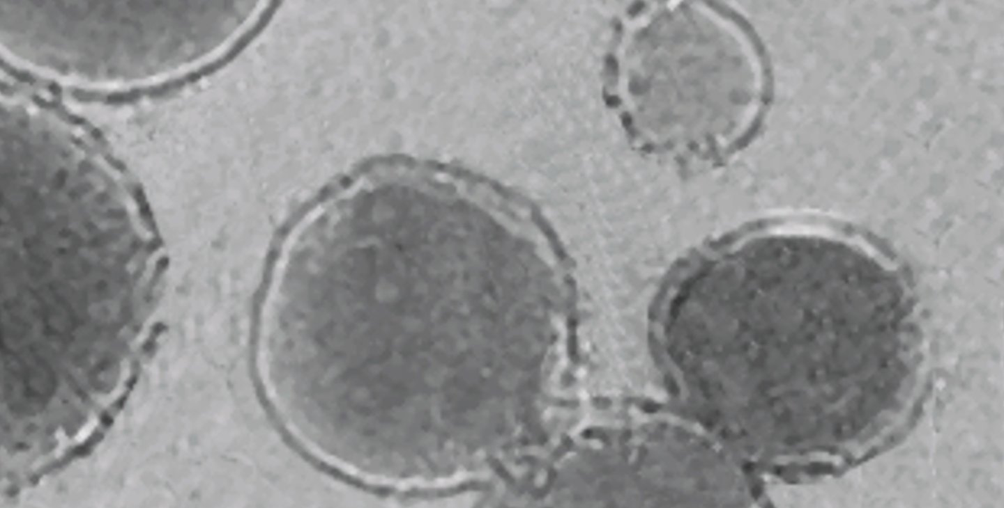 A black and white microscope image of liposomes which look like cellular structures.