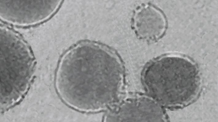 A black and white microscope image of liposomes which look like cellular structures.