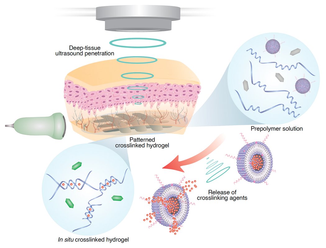 A schematic showing how in vivo sound printing works. "Deep-tissue ultrasound penetration" is labeled above tissue where "patterned crosslinked hydrogel" is shown forming. "Prepolymer solution," "Release of crosslinking agents," "crosslinked hydrogel."