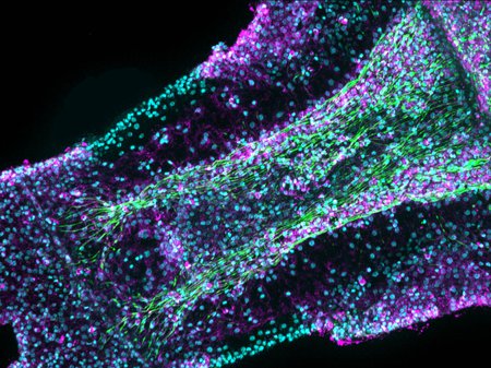 A close up shot of a jellyfish arm with cells labeled in purple and teal