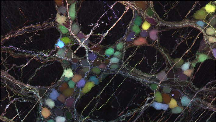 Multicolored neurons in the digestive tract