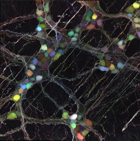 Multicolored neurons in the digestive tract