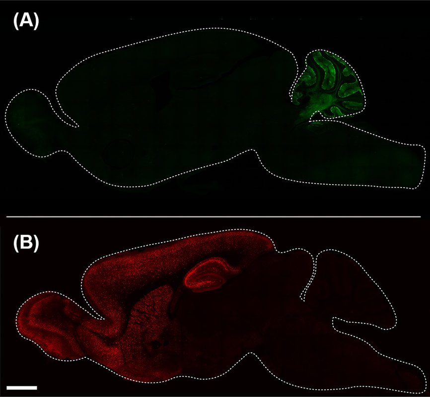 Two different parts of the mouse brain colored in red and green.