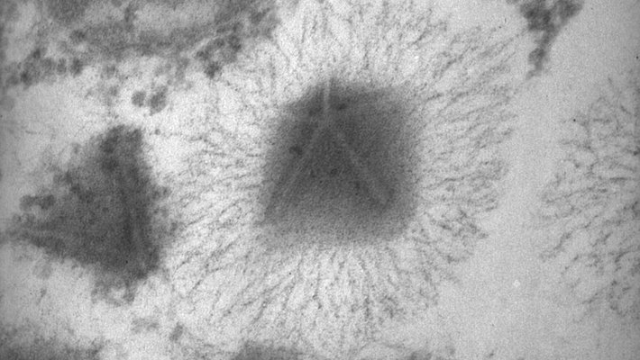 A black and white transmission electron microscopy image of a mimivirus exhibiting the distinctive stargate structure