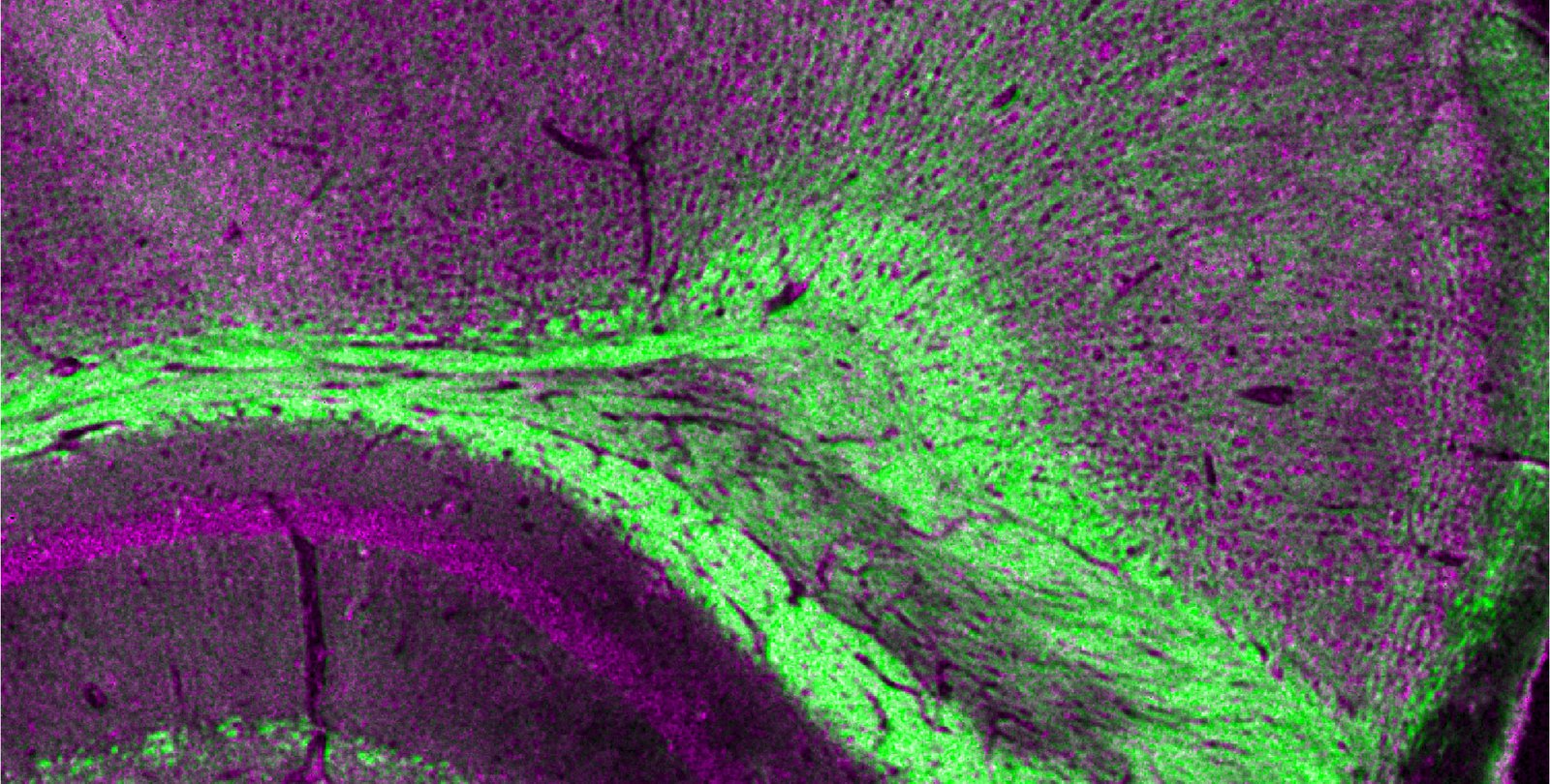 A region of a mouse imaged by the dual-laser microscopy technique. It is a purple and green cross section of tissue.