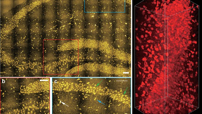 Cell imagery from the lab of Lu Wei. Super-resolution and volumetric tissue imaging by specialized microscopy can map chemical vibrations from proteins in the brain.