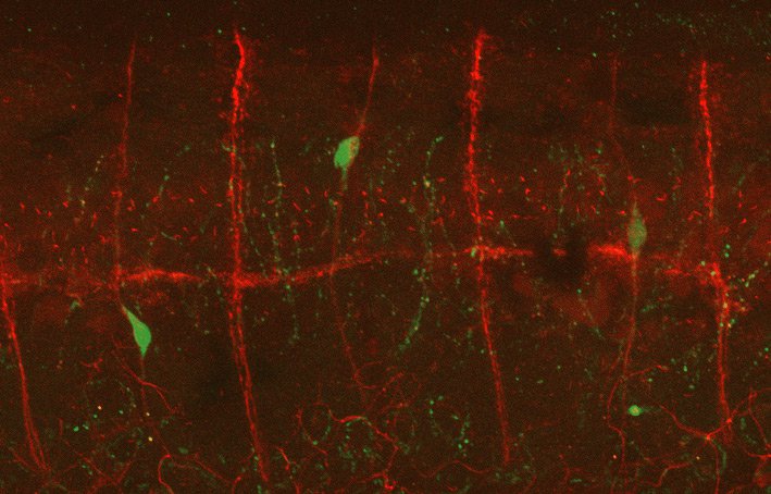 Migratory neuroblasts (embryonic nerve cells) traveling across spinal nerves (red) to reach the gut.