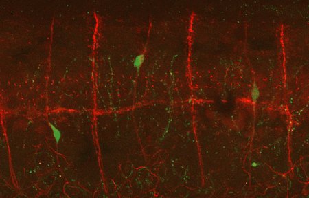 Migratory neuroblasts (embryonic nerve cells) traveling across spinal nerves (red) to reach the gut.