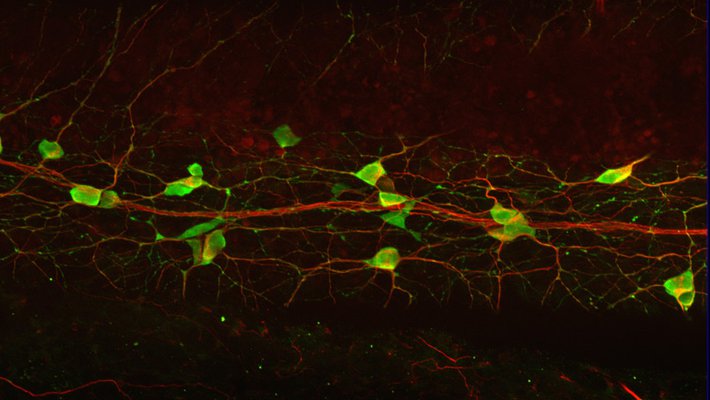A side view of the lamprey gut, showing many large serotonergic neurons (green) sitting on the side of the gut. 