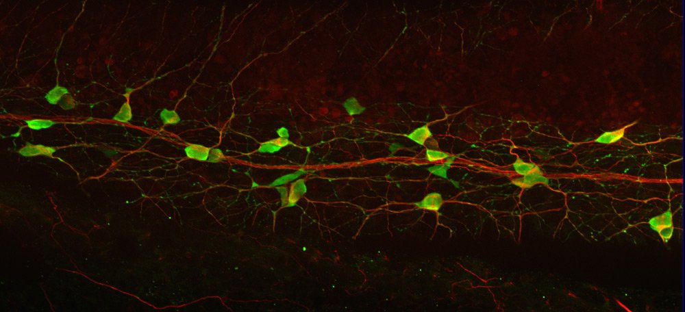 A side view of the lamprey gut, showing many large serotonergic neurons (green) sitting on the side of the gut. 