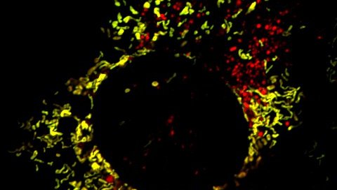 A swirl of red and yellow dots