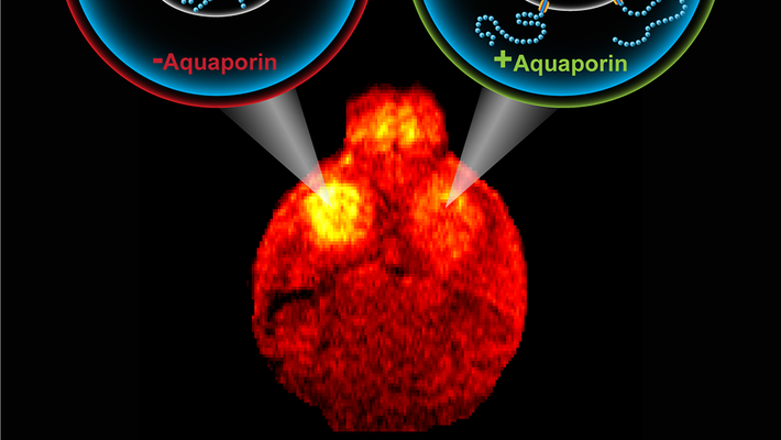 An illustration of aquaporin's effect on cells.