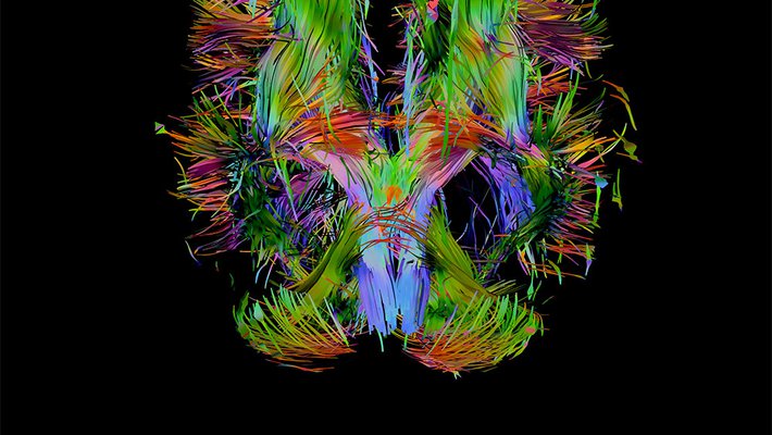 Visualization of a brain.