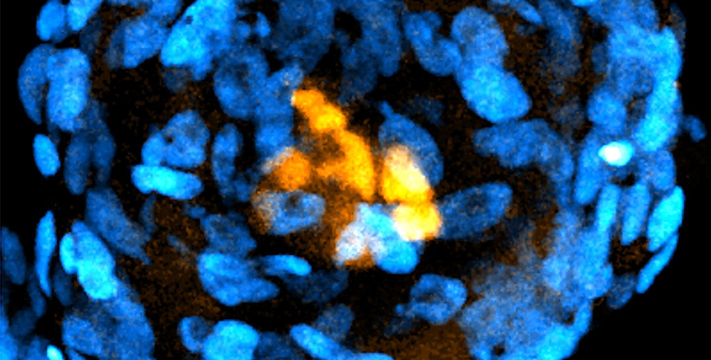 A spherical structure composed of blue oval-shaped cells, with a center of yellow cells