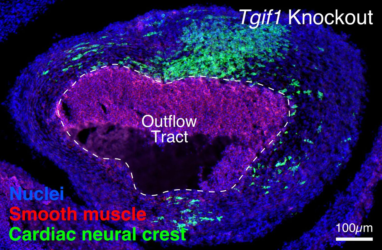 A chicken embryo heart with developmental defect