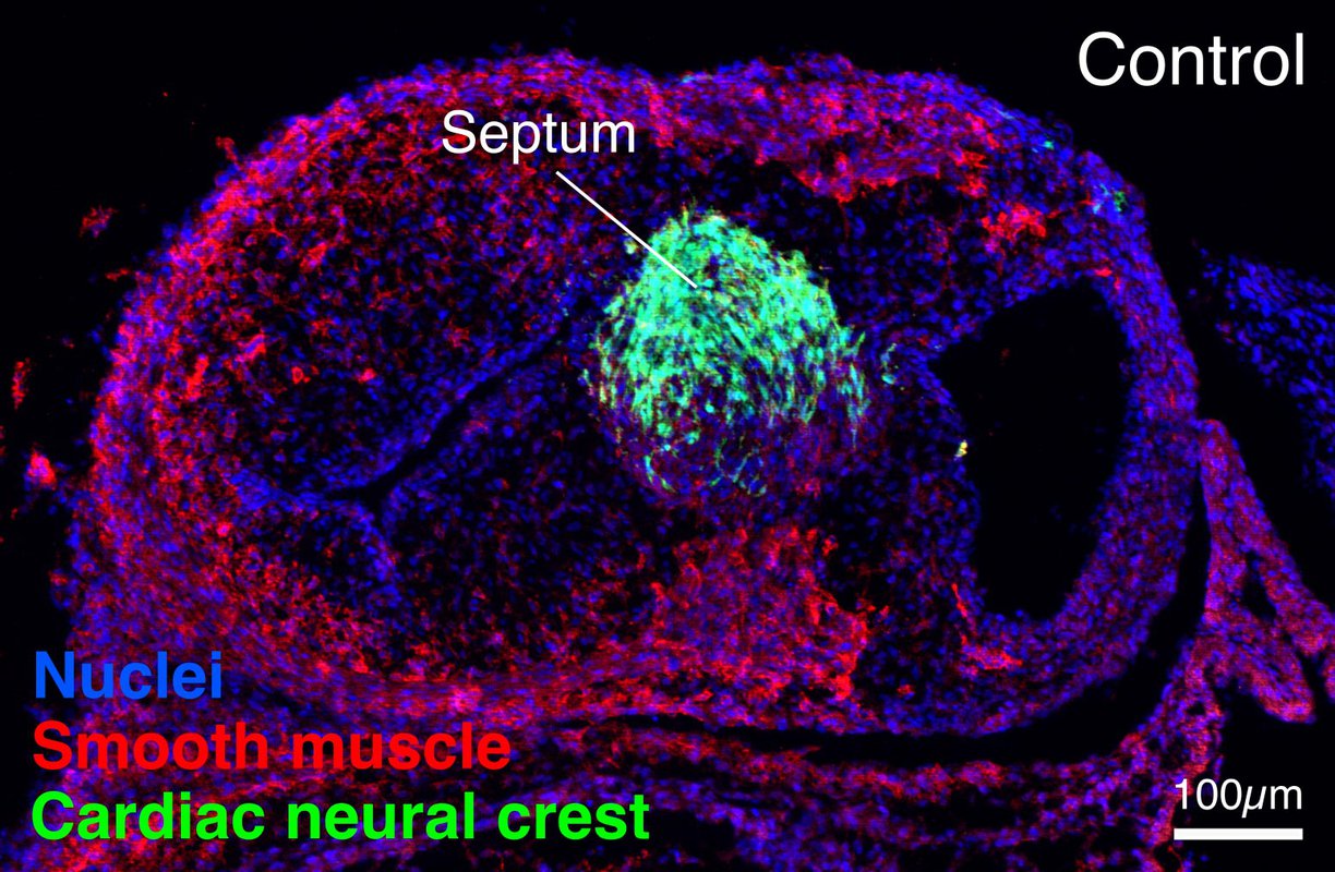 A six-day-old chicken embryo heart with neural crest cells labeled in green