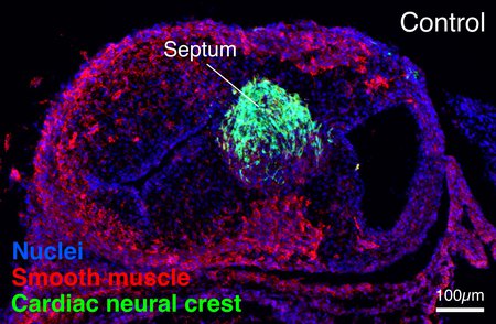 A six-day-old chicken embryo heart with neural crest cells labeled in green