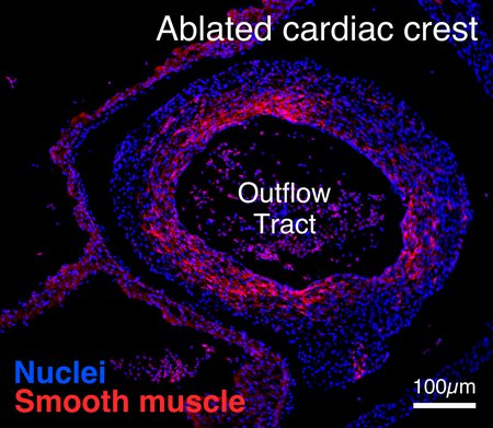 A chicken embryo heart with developmental defect