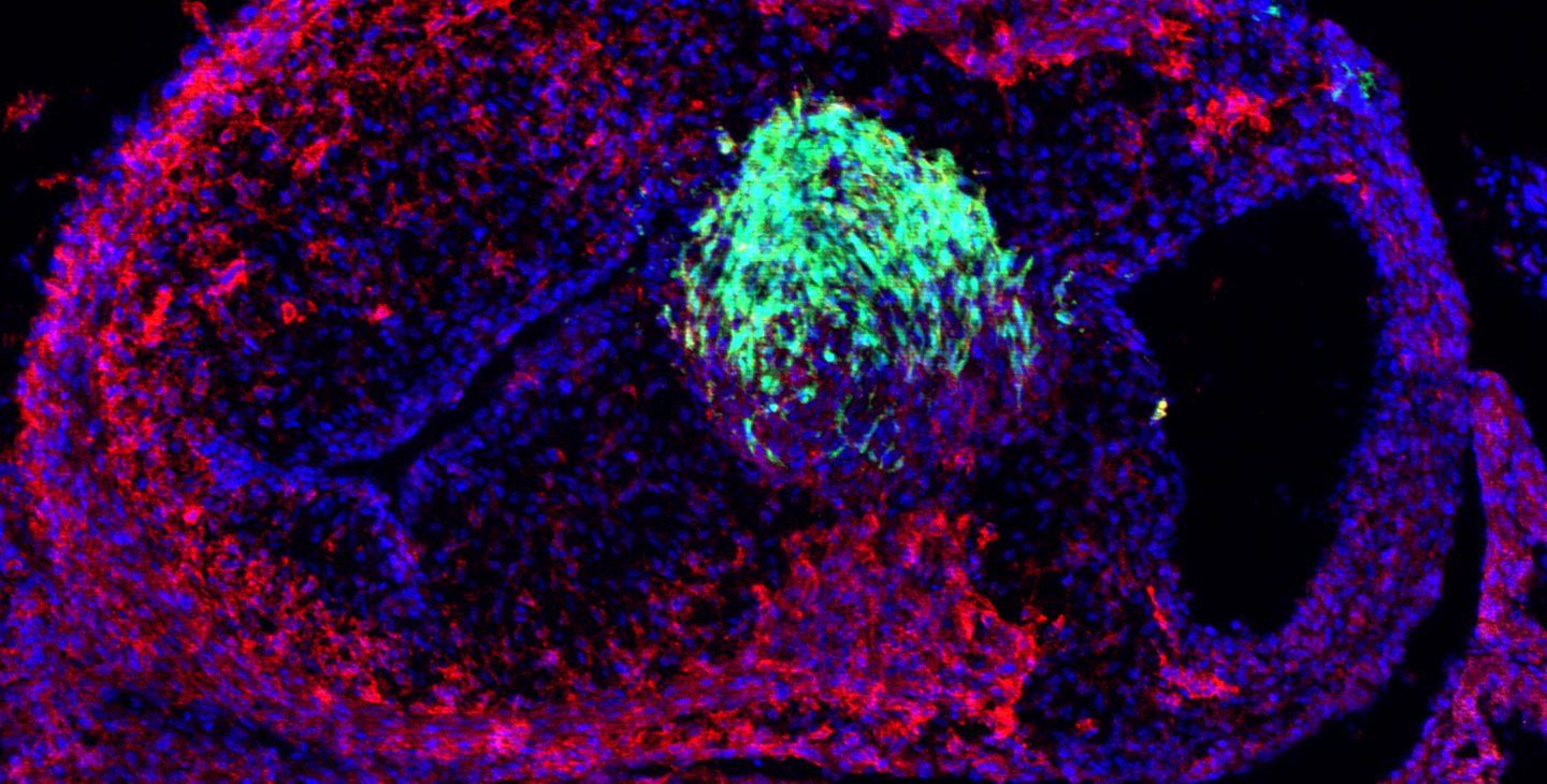 A chicken embryo heart with neural crest cells labeled in green