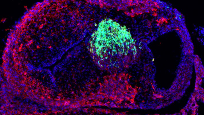 A chicken embryo heart with neural crest cells labeled in green
