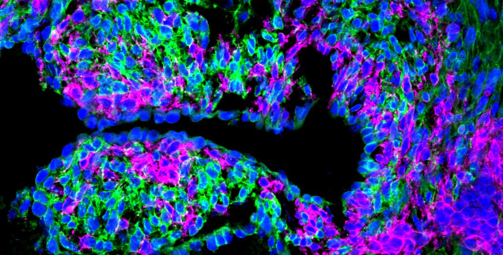 Colorful cells labeled in the embryonic mouse heart
