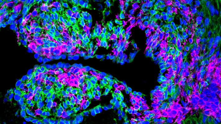 Colorful cells labeled in the embryonic mouse heart
