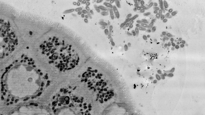 An electron microscopy image of a section of the mouse gut, showing B. fragilis aggregating close to the epithelial cells that make up the lining of the gut.
