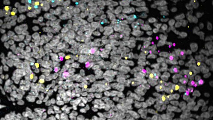 Image of cells glowing with colorful markers